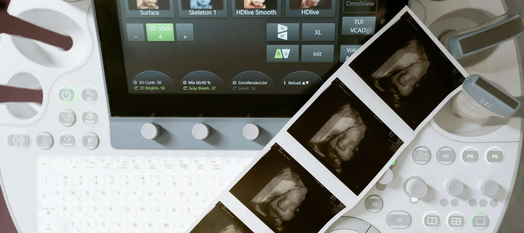 3D Röntgen DVT - Dreidimensionale Darstellung des Kieferbereichs