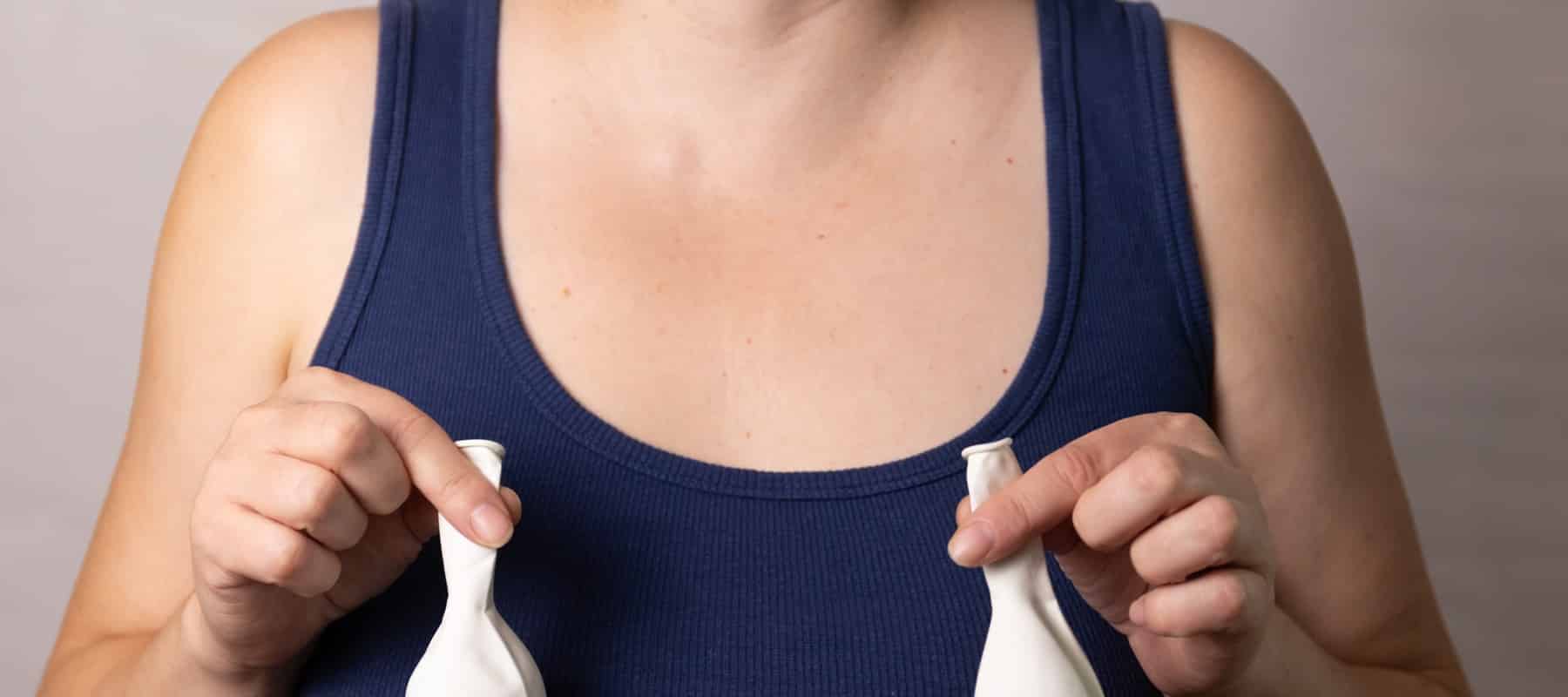 Mommy Makeover - Ergebnis nach Behandlung