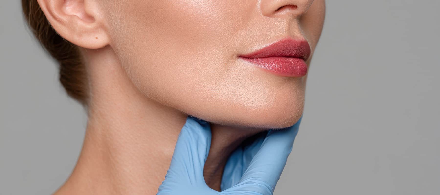 Cheek Filler Wangenfiller Behandlung Injektion