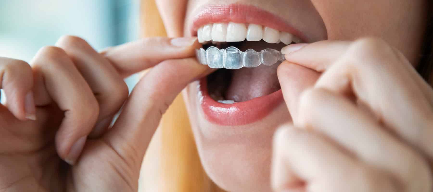 Zahnspange Schmerzen – Kühlung der Wange mit Kühlpad