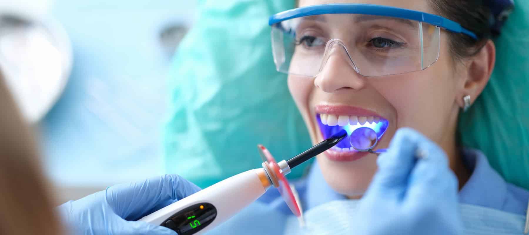 Composite Bonding