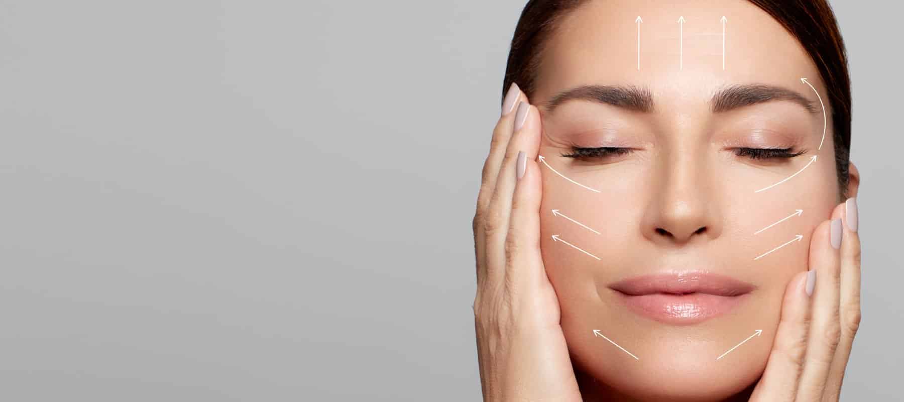 Deep Plane Facelift Ergebnis natürliche Verjüngung