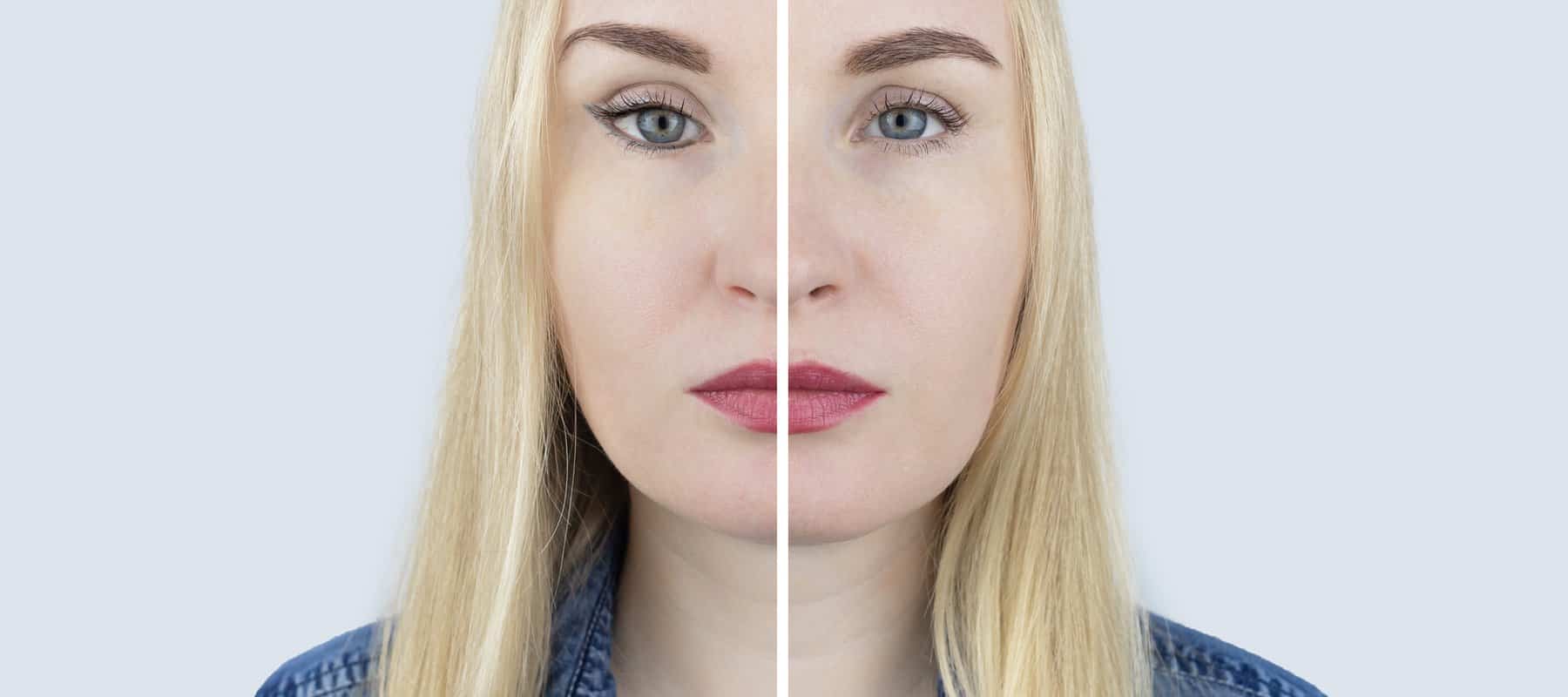 Fox Eye Lift