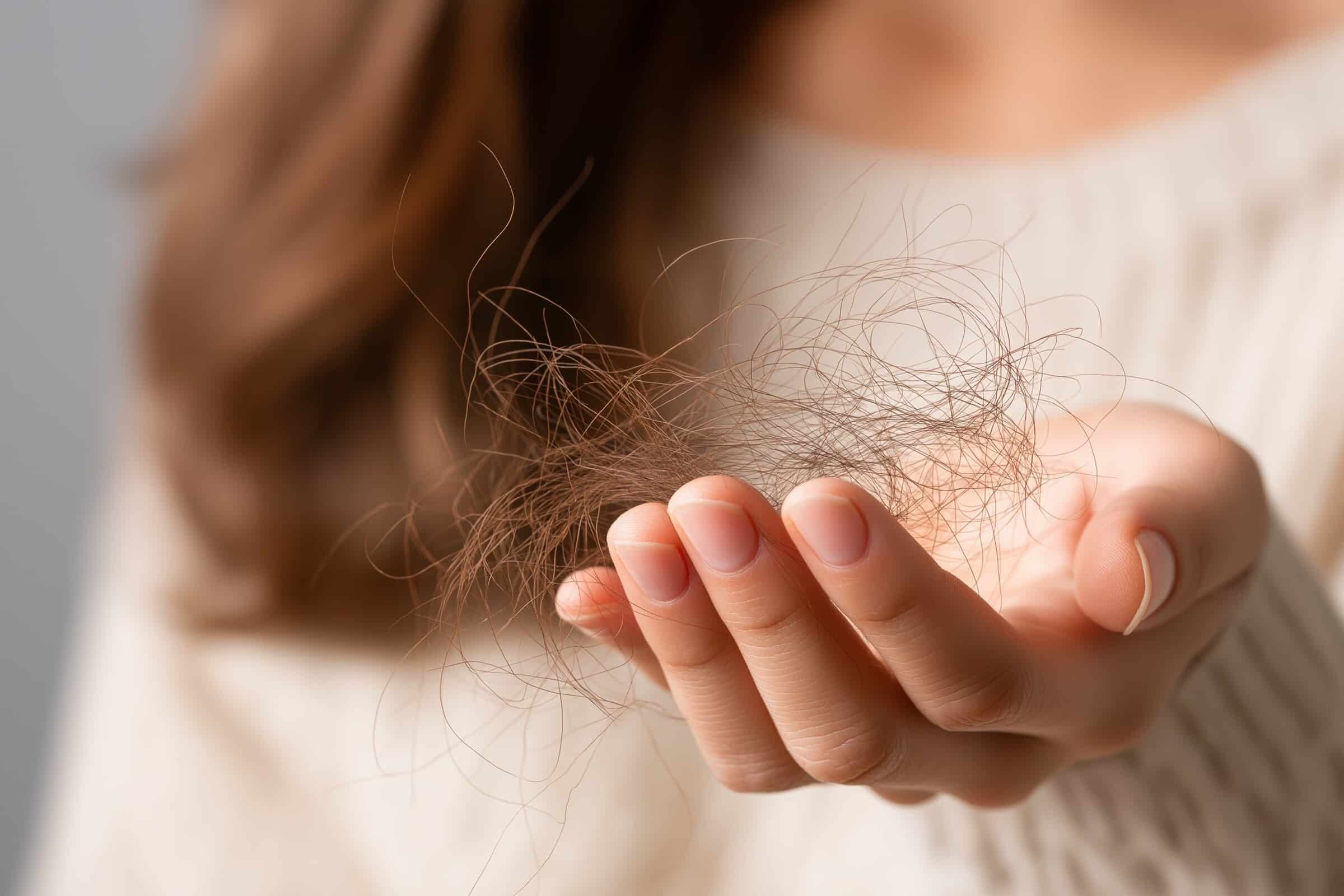 Haarausfall Wechseljahre – Diagnostik beim Dermatologen