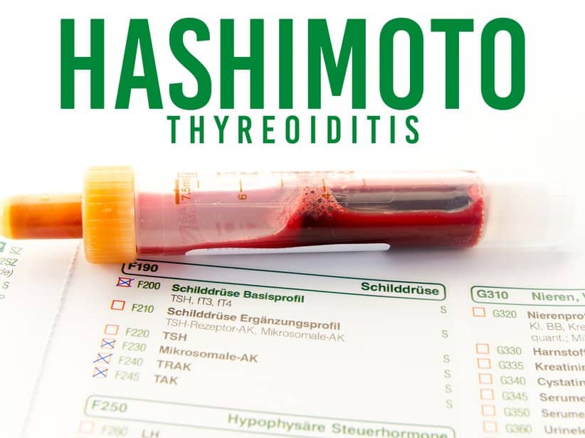 Schilddrüsenunterfunktion – Nahaufnahme L-Thyroxin-Tabletten neben Wasserglas auf hellem Untergrund