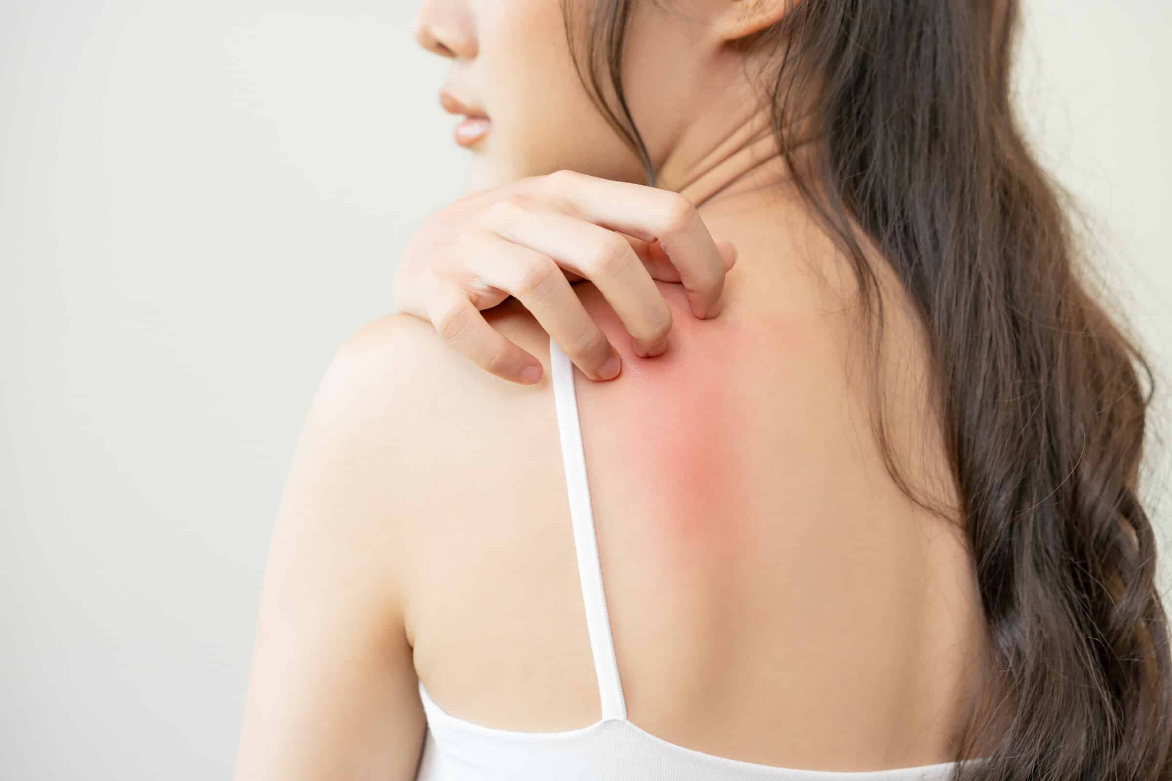 Juckreiz (Pruritus) – Welche inneren Erkrankungen können Juckreiz verursachen