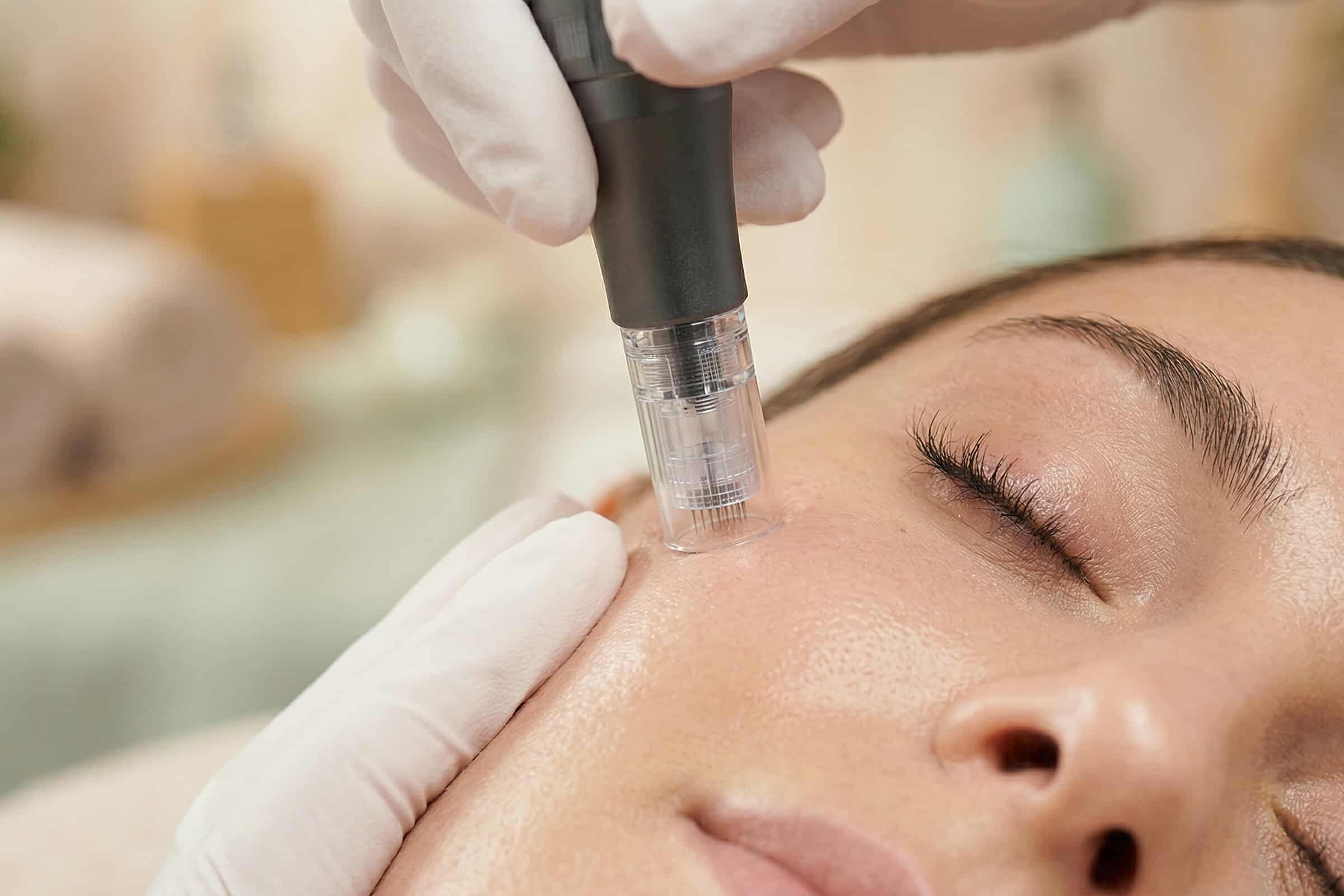 Beratungsgespräch vor einem nicht chirurgischen Facelift