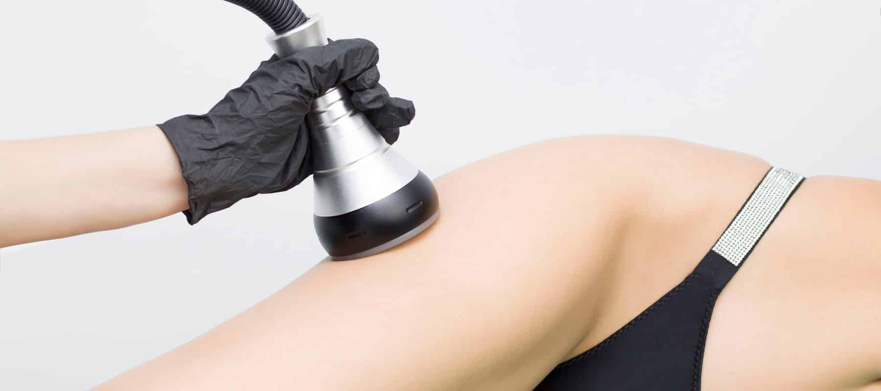 Vakuummassage-Handstück gleitet über den Oberschenkel zur Behandlung von Cellulite