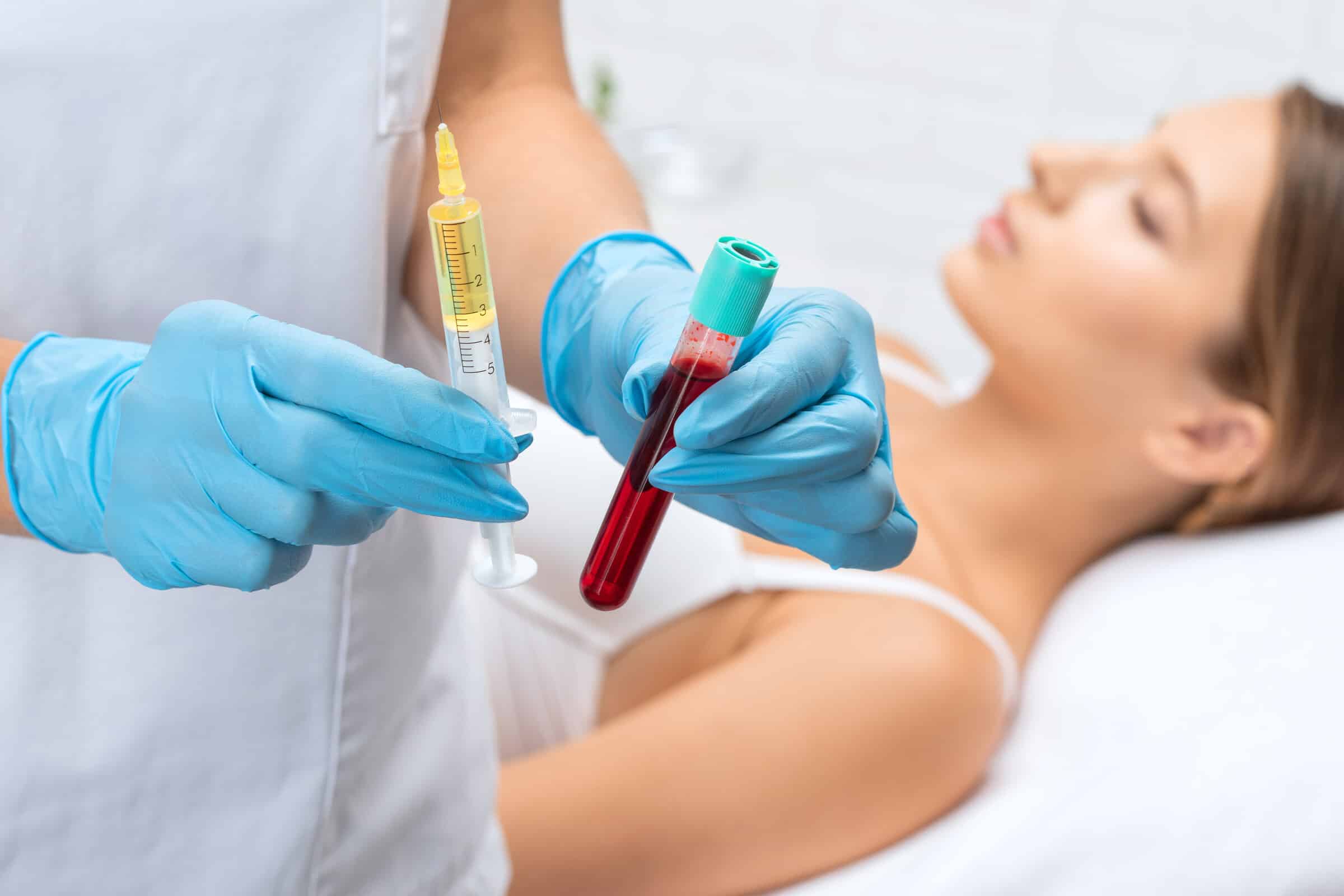 Aufbereitung von plättchenreichem Plasma in der Zentrifuge