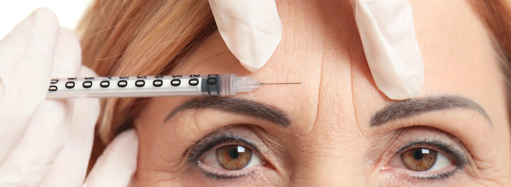 Botulinumtoxin (Botox©) - Was sind weitere Anwendungsgebiete von Botulinumtoxin?