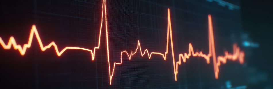 Bei bestimmten Risikofaktoren führt ein Arzt vor Operationen standardmäßig ein Ruhe-EKG durch