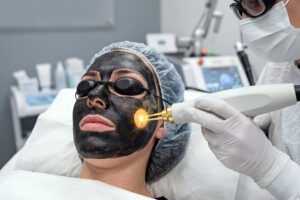 September ist Lasersaison: Warum Peeling und Laser im Herbst starten sollten