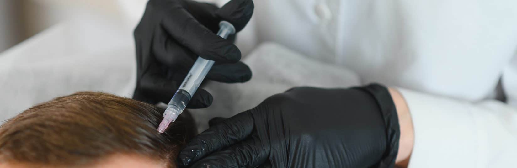 Mikrohaarpigmentierung - Was versteht die Medizin unter einer Mikrohaarpigmentierung?