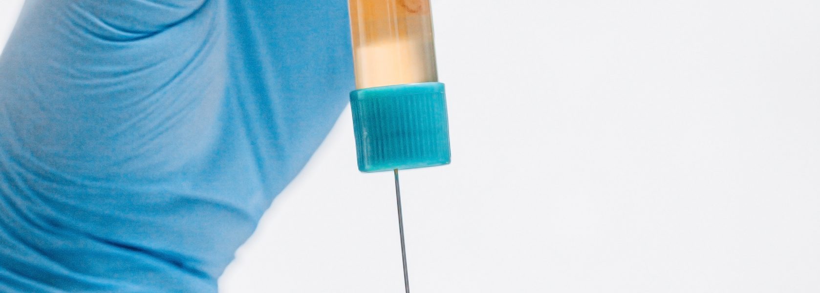 PRP-Behandlung (Vampir Lifting) - Wann ist eine PRP-Behandlung nicht geeignet?