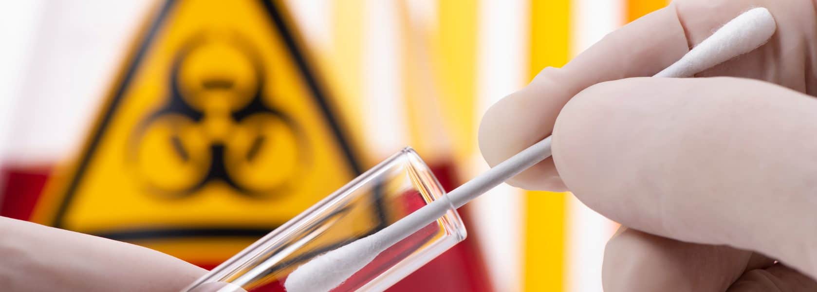 Syphilis - Kann ich mich auch selbst auf Syphilis testen?