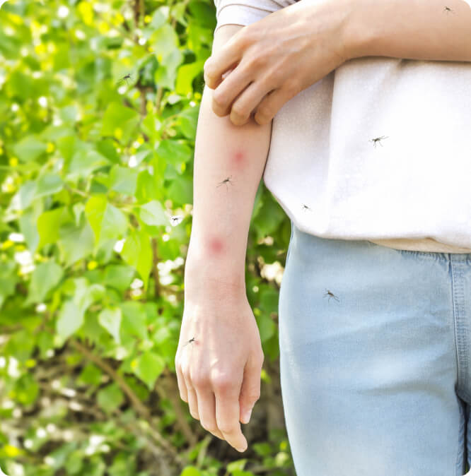 Allergie - Welches Insektengift löst eine allergische Reaktion aus?