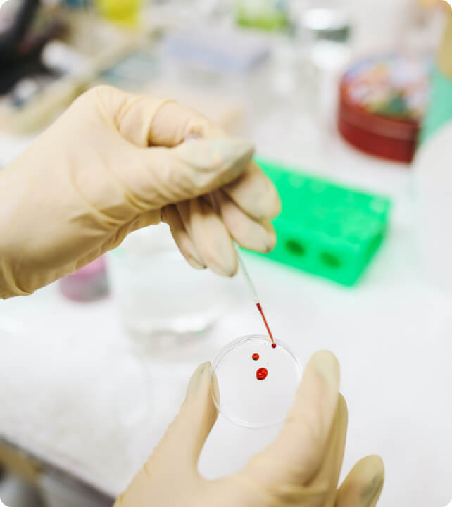 Chlamydien - Wie funktionieren die verschiedenen Chlamydien-Tests?