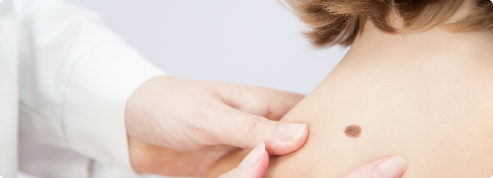 Hautkrebsvorsorge (Muttermalkontrolle) - Welche Methoden der Hautkrebsvorsorge gibt es?