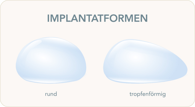 Implantatwahl – welche Rolle spielen die Implantatoberflächen? - Rund oder anatomisch? – Die Implantat-Form