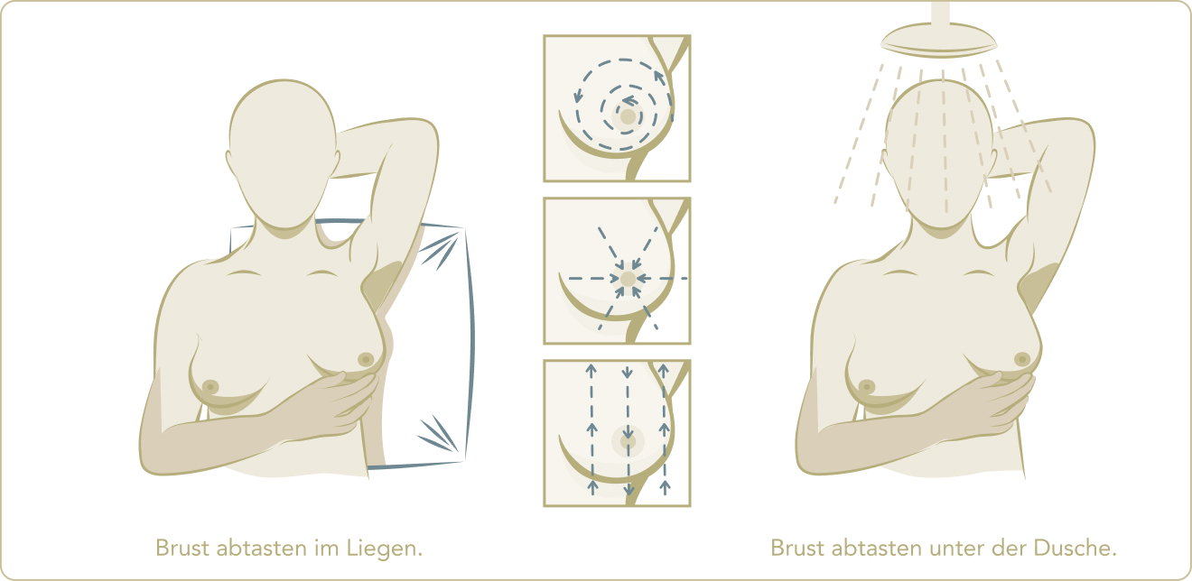 Mammographie  - Wie kann ich meine Brüste auf Veränderungen abtasten?