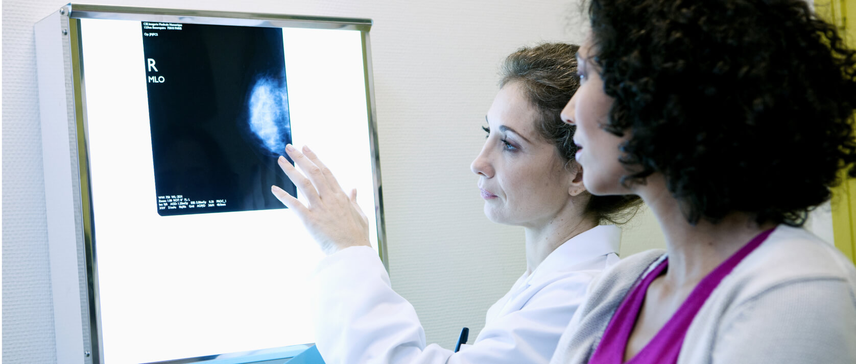 Mammographie  - Was sind die möglichen Spätfolgen einer Mammographie?