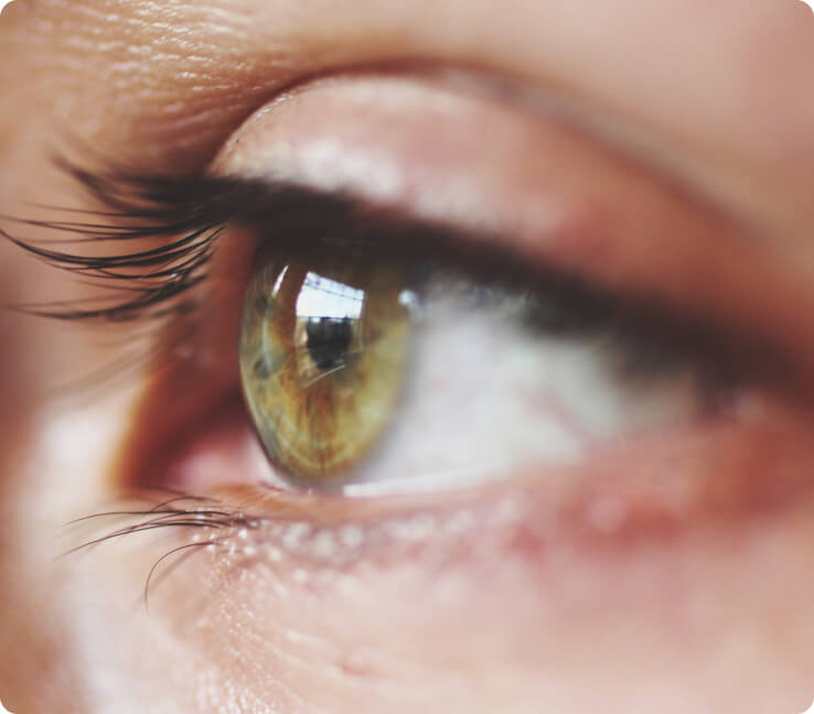 Ektropium - Ebenfalls können Tumore im Augenbereich für Ektropien sorgen