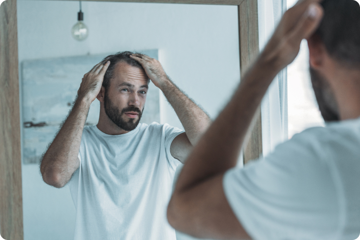 Mikrohaarpigmentierung - Was sind die Gründe für Haarausfall?