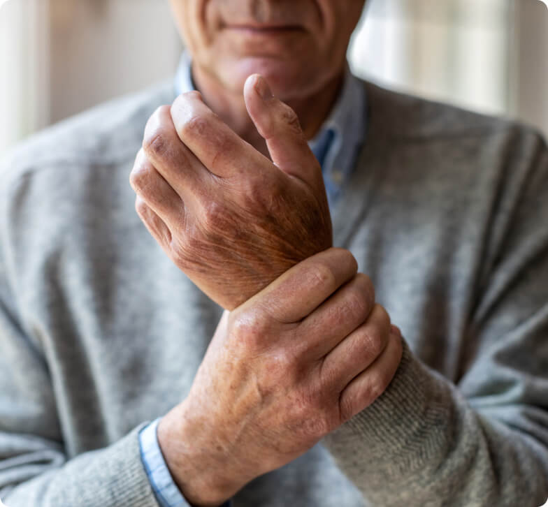 Arthritis - schmerzende Gelenke
