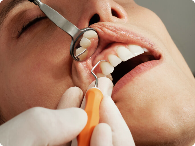 Zahnschmerzen - Was macht der Arzt
