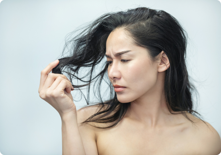 Haarausfall - Rundliche, völlig kahle Stellen auf der Kopfhaut