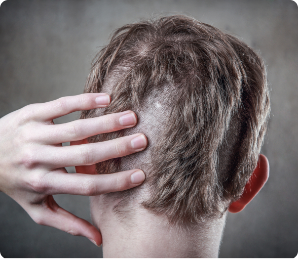 Haarausfall - Welche Ursachen kann Haarausfall bei Kleinkindern haben?