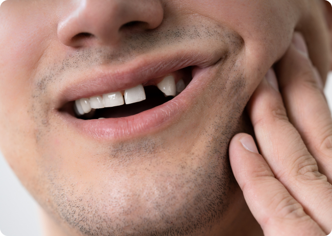 Hypodontie - Welche Folgen kann die Hypodontie für den Betroffenen haben? Was kann passieren, wenn man den fehlenden Zahn nicht ersetzt?