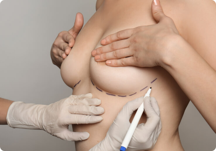 Hochwertige Brustimplantate - Wie kann ich mich sicher sein, dass ich hochwertige Implantate eingesetzt bekomme?
