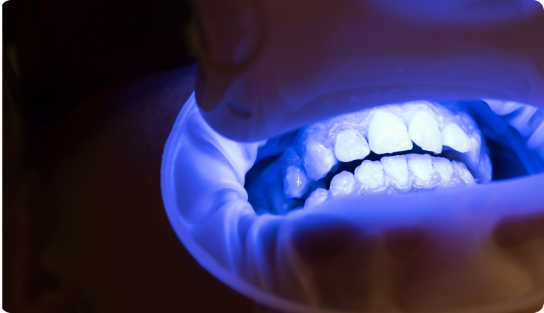 Zahnbleaching - Wie ist die Haut aufgebaut und was ist ihre Aufgabe?