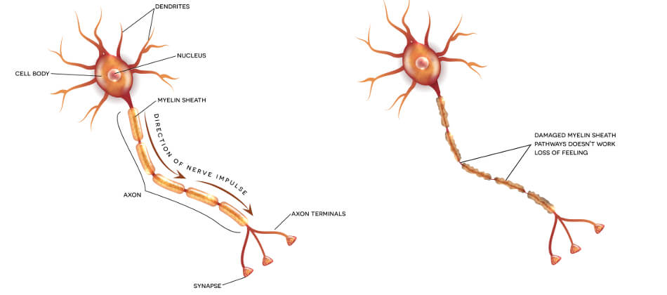 Rekonstruktion der Nervenfaser