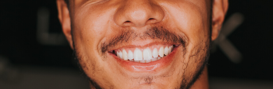 Gingivahyperplasie beschreibt eine Wucherung des Zahnfleisches