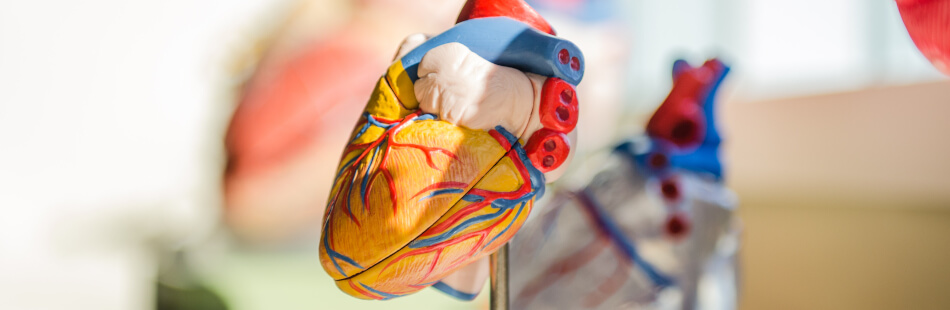 Koronare Herzkrankheit meint eine Sauerstoff-Unterversorgung des Herzends durch eine Verengung der Herzkranzgefäße
