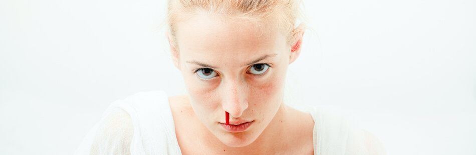Die Symptome der Mastozytose sind vielfältig. Auch Nasenbluten gehört dazu.