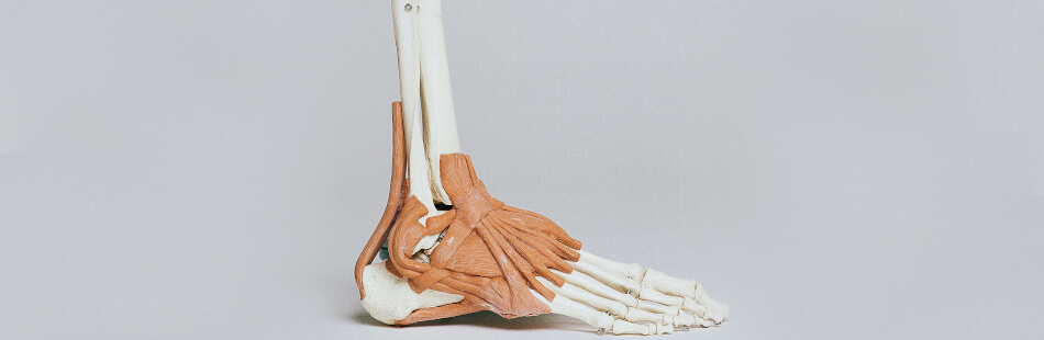 Die Plantarfasziitis bezeichnet eine Entzündung der Sehnenplatte unter dem Fuß.