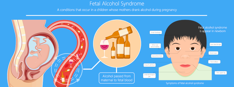Zeichen für das Fetale Alkoholsyndrom lassen sich oftmals äußerlich sehen, aber auch körperlich hat es negative Konsequenzen