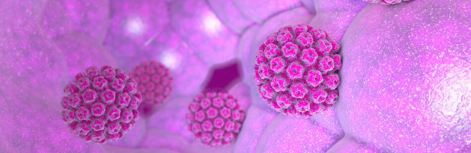 Die humane Papillomviren können nicht nur die Schleimhaut, sondern auch die äußere Haut befallen. Dies zeigt sich als Warzen