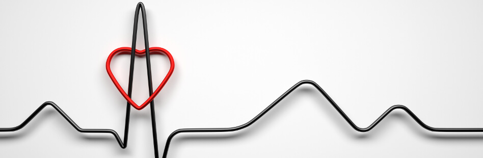 Das EKG überträgt die elektrische Herzaktivität als Kurve gegen eine Zeitachse auf ein Millimeterpapier