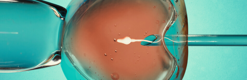 Eine beliebte Behandlung bei Unfruchtbarkeit ist die In-vitro-Fertilisation.