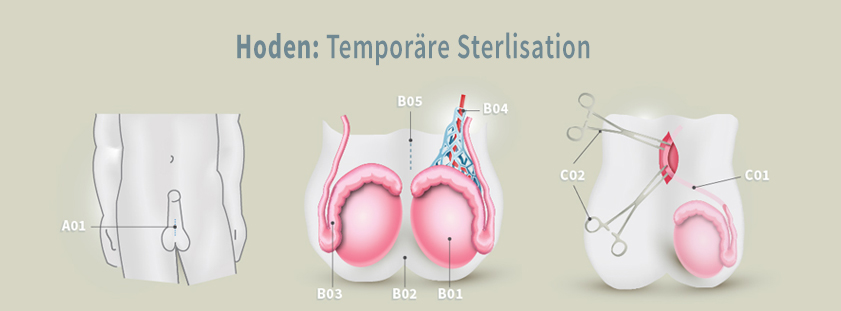 Temporäre Sterilisation