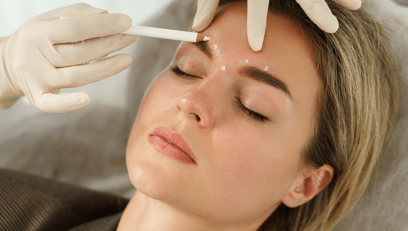 Filler & Botox im Winter – Warum jetzt die beste Zeit ist - MOOCI