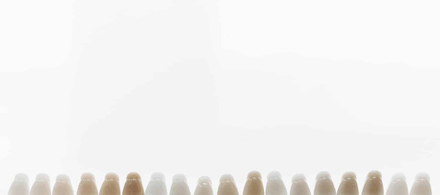 Zahnersatz - Verschiedene Formen von festsitzendem Zahnersatz