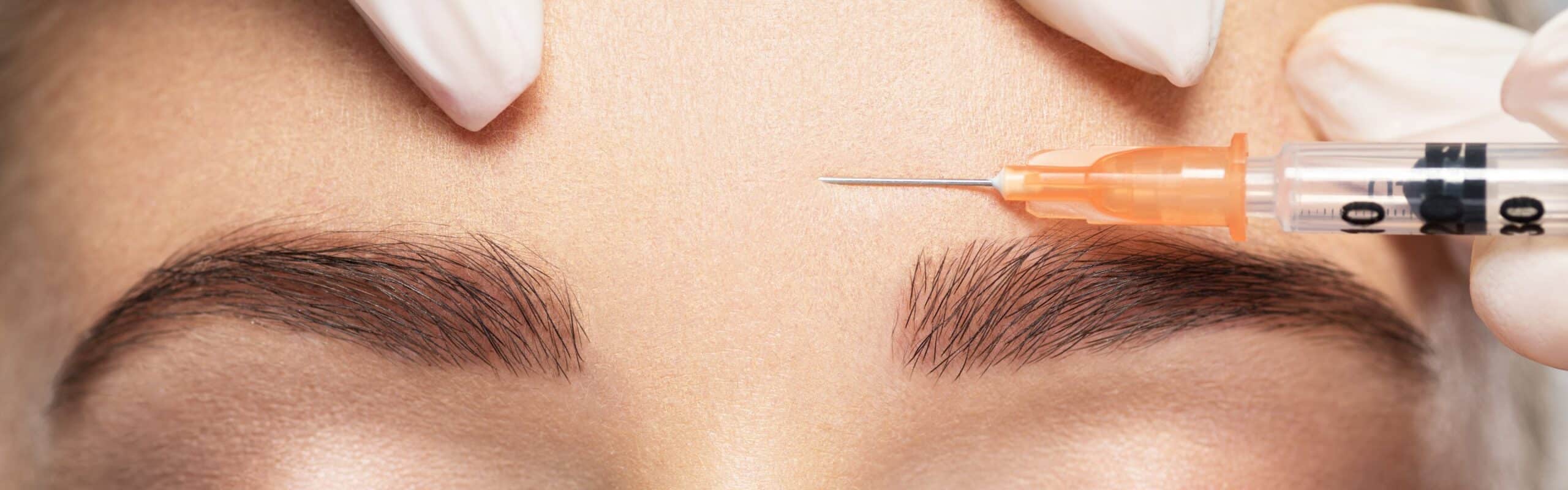 Relfydess: Was kann Galdermas neuer Botox-Konkurrent?