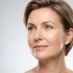 Invisilift: Das nicht-invasive Facelift, das immer mehr OPs ersetzt