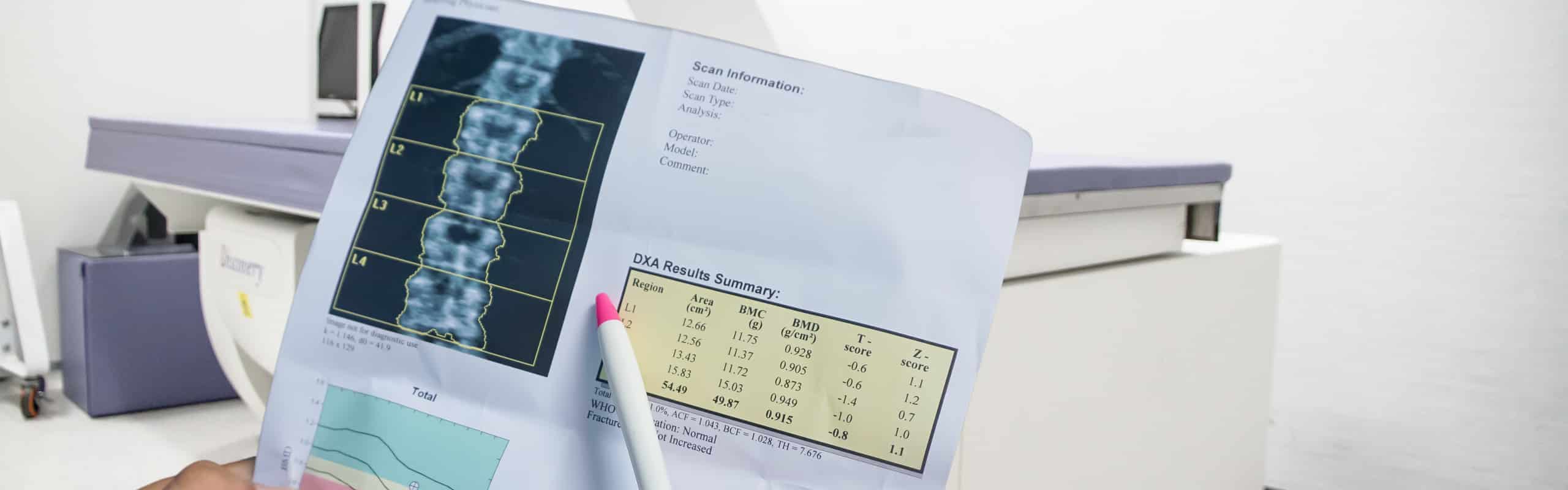 DEXA-Scan