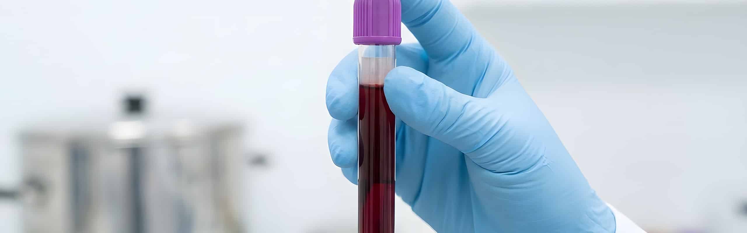 Laborwerte der Vorsorgeuntersuchung